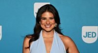 Remi Bader Reveals Exactly Where She Gets Botox and Shares Her ‘Before’ Look