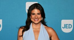 Remi Bader Reveals Exactly Where She Gets Botox and Shares Her ‘Before’ Look