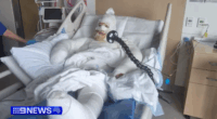 'Like being fried': WA mum suffers serious burns in firebombing