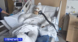 'Like being fried': WA mum suffers serious burns in firebombing