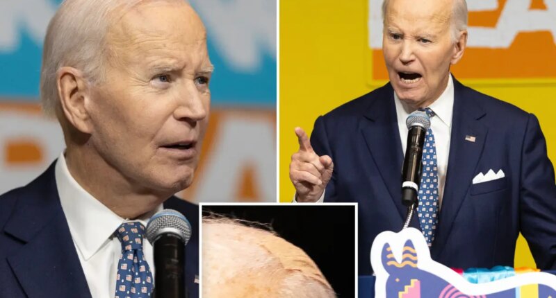 Bandaged-up Biden says son Beau ‘should've been the president, not me’ in speech ripping Trump