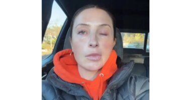 Bristol Palin Says Face Is 'Still Crooked' 1 Year After Paralysis Battle