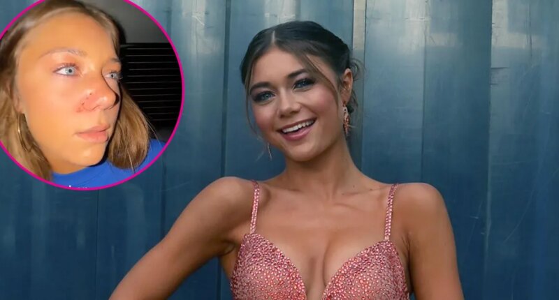 DWTS’ Hailey Bills Reveals Possible Broken Nose After Wild Thanksgiving Game