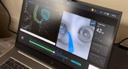 Florida hospital using robotics for lung cancer treatment