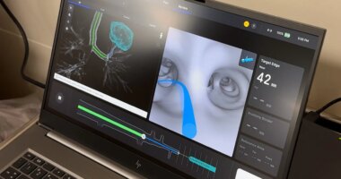 Florida hospital using robotics for lung cancer treatment