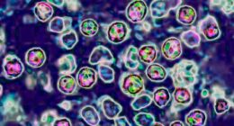 Highly infectious, deadly disease 'likely circulating' in Sydney