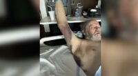 'How could you do that to an elderly person': 73-year-old man with dementia attacked by hospital worker at HCA Orange Park, family demands answers