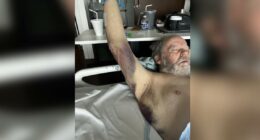 'How could you do that to an elderly person': 73-year-old man with dementia attacked by hospital worker at HCA Orange Park, family demands answers