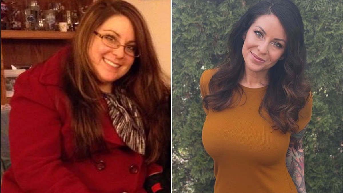 I was a hypocritical obese doctor. Then I lost 120 lbs without Ozempic