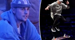 Justin Bieber suffers ‘gnarly’ fall from electric skateboard: ‘My rib hurts so f–king bad’