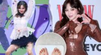 K-pop star HyunA collapses mid-performance, sparking concern over recent weight loss