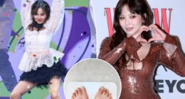 K-pop star HyunA collapses mid-performance, sparking concern over recent weight loss