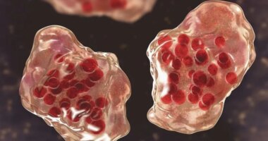 Metro Public Health Department confirms first measles case in Nashville since 2005