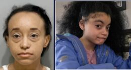 Mom beat nonverbal teen daughter with autism to death: Cop