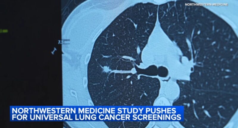 Northwestern Medicine study recommends expanding ages for lung cancer screening