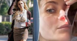 Paris Jackson defends sharing graphic photo of her perforated septum from years of drug abuse