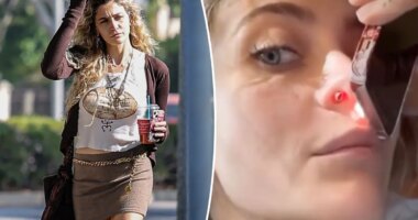 Paris Jackson defends sharing graphic photo of her perforated septum from years of drug abuse