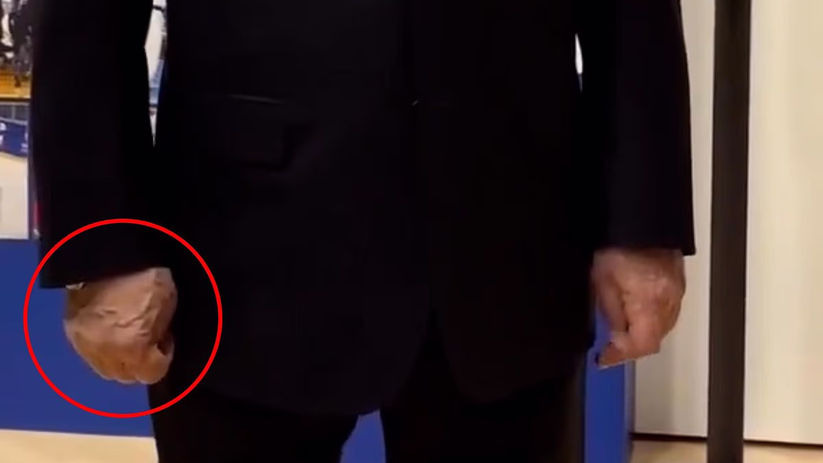 Putin's HANDSHAKE with health expert sparks new debate over wellbeing