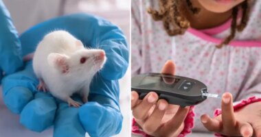 Scientists identify potential type 1 diabetes cure in milestone study