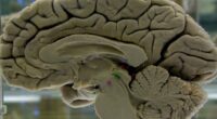 Your brain isn't fully 'adult' until age 32, scientists say