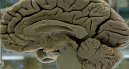 Your brain isn't fully 'adult' until age 32, scientists say