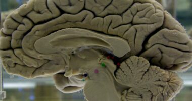 Your brain isn't fully 'adult' until age 32, scientists say