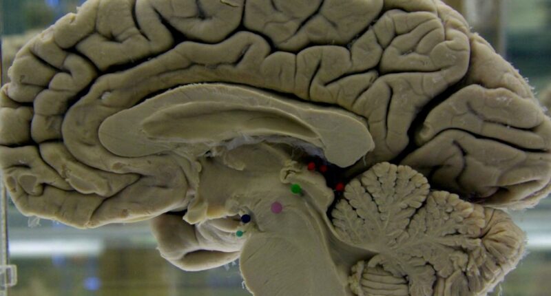 Your brain isn't fully 'adult' until age 32, scientists say