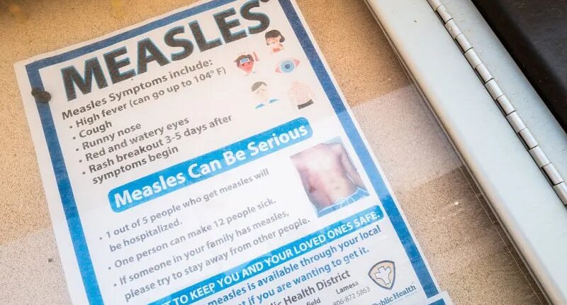 14 new measles cases reported in South Carolina, brings total to 79 for 2025