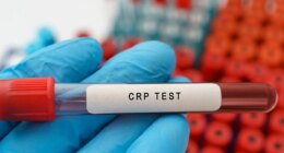 C-reactive protein outranks ‘bad’ cholesterol as leading heart disease risk marker
