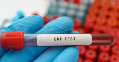 C-reactive protein outranks ‘bad’ cholesterol as leading heart disease risk marker