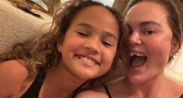 CHRISSY TEIGEN LOSES A VENEER DURING HOLIDAY ACTIVITY WITH HER KIDS
