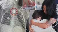 Colorado mom, Jess Sandoval, warns parents about button batteries in Christmas toys after daughter swallows one