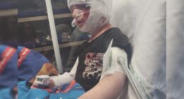 'Complete shock': Jacksonville mom recounts dog attack where 4-year-old son's ear was ripped off