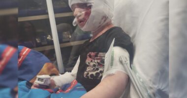 'Complete shock': Jacksonville mom recounts dog attack where 4-year-old son's ear was ripped off