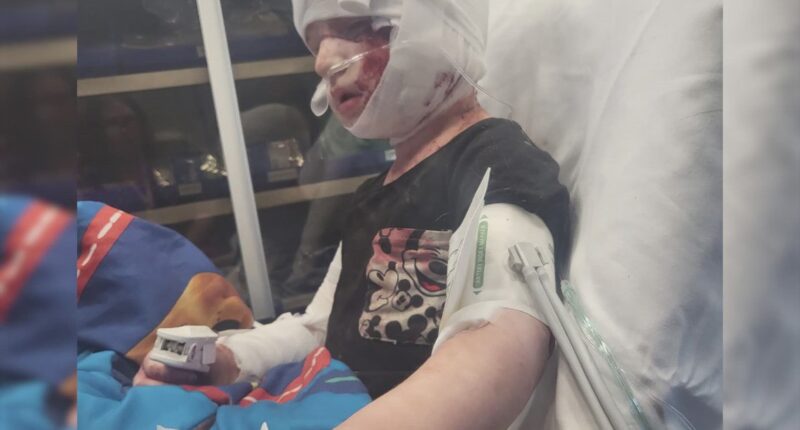 'Complete shock': Jacksonville mom recounts dog attack where 4-year-old son's ear was ripped off