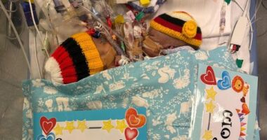 O﻿ne of the conjoined twins who were flown from Papua New Guinea to Australia in a desperate attempt to save them has died following an emergency surgery.