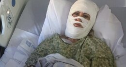 Georgia woman hospitalized after attacker hurls corrosive chemical during evening walk