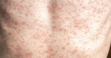 RFK Jr. Needs to 'Unconditionally' Advocate for Measles Vaccine, Lack of Vaccination Causing Deaths, Outbreak