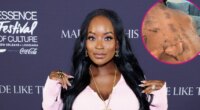 RHOA’s Shamea Morton Sues Doctor Over Chemical Peel Gone Wrong