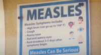 S.C. measles cases surge, doctor talks local outbreak fears