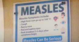 S.C. measles cases surge, doctor talks local outbreak fears