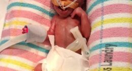 baby Charlie Jones is Queensland's smallest newborn