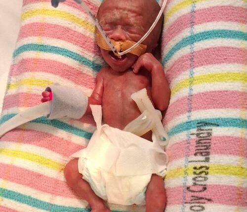 baby Charlie Jones is Queensland's smallest newborn