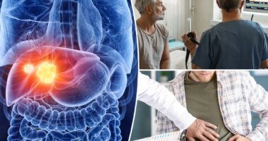 'Troubling' colorectal cancer complication is highest in those under 50