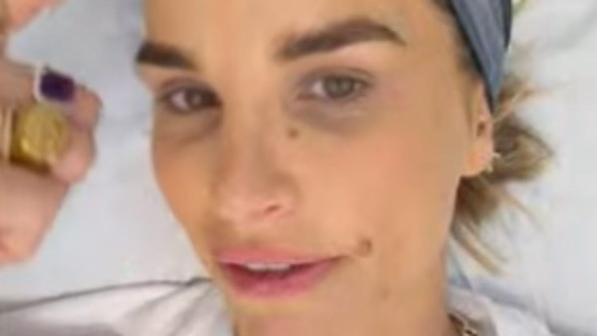 Vogue Williams reveals cosmetic tweakments she's had after I'm A Celeb