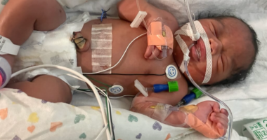 ‘She was a miracle baby’: Family of Tampa newborn shot in the womb speaks