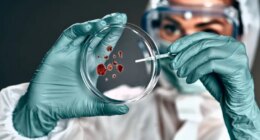 2 viruses could become next public health threats, scientists say