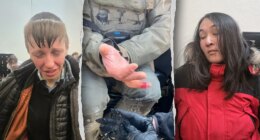 Anti-ICE agitator allegedly bites off federal officer's finger during Minneapolis attack