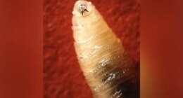 CDC warns doctors to look for screwworm symptoms. What are they?