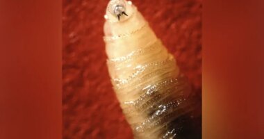 CDC warns doctors to look for screwworm symptoms. What are they?
